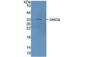 Figure. (PCDH15 anticorps  (AA 45-270))