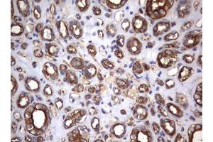 Image no. 18 for anti-Tumor Necrosis Factor Receptor Superfamily, Member 8 (TNFRSF8) (AA 19-379) antibody (ABIN1491084)