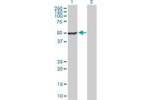 Western Blot analysis of NR0B1 expression in transfected 293T cell line by NR0B1 MaxPab polyclonal antibody. (NR0B1 anticorps  (AA 1-470))
