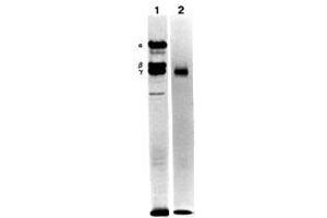 Immunoprecipitation of the culture medium of human pancreatic carcinoma cells (metabolically labeled with S35Ðmethionine) with MAb BC17 (Laminin g1) (Lane 1). (Laminin gamma 1 anticorps)