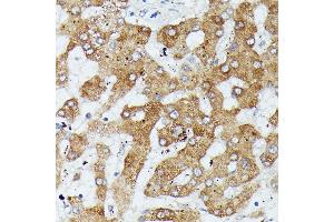 Immunohistochemistry of paraffin-embedded human liver using MK1 antibody (ABIN7268647) at dilution of 1:100 (40x lens).