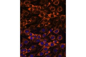 Immunofluorescence analysis of C6 cells using  antibody (ABIN7265368) at dilution of 1:100. (ACAA2 anticorps  (AA 1-250))