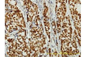 Image no. 1 for anti-Non-SMC Condensin II Complex, Subunit D3 (NCAPD3) (AA 1-341) antibody (ABIN466186) (NCAPD3 anticorps  (AA 1-341))