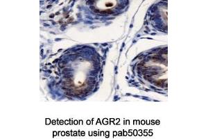 Image no. 2 for anti-Anterior Gradient Homolog 2 (Xenopus Laevis) (AGR2) (AA 50-100) antibody (ABIN363664) (AGR2 anticorps  (AA 50-100))