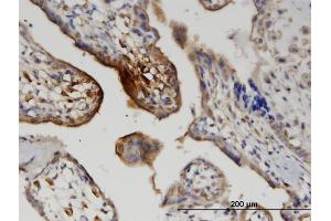 Immunoperoxidase of monoclonal antibody to WNT5A on formalin-fixed paraffin-embedded human placenta.