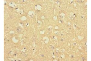 Immunohistochemistry of paraffin-embedded human brain tissue using ABIN7158190 at dilution of 1:100 (LRRC4C anticorps  (AA 201-500))