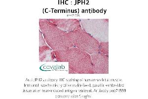 Image no. 2 for anti-Junctophilin 2 (JPH2) (C-Term) antibody (ABIN1736131) (Junctophilin 2 anticorps  (C-Term))