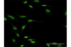 Immunofluorescence of purified MaxPab antibody to ZNF71 on HeLa cell. (ZNF71 anticorps  (AA 1-489))