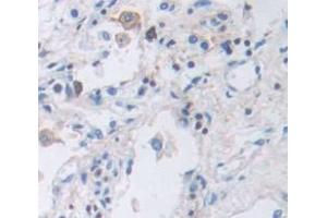 IHC-P analysis of Human Tissue, with DAB staining. (Integrin beta 2 anticorps  (AA 451-627))