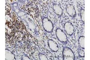 Immunoperoxidase of monoclonal antibody to CSK on formalin-fixed paraffin-embedded human colon.