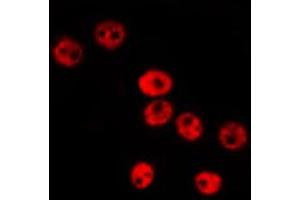 ABIN6274019 staining Hela by IF/ICC. (ID1 anticorps  (Internal Region))