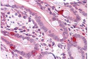 Human Small Intestine: Formalin-Fixed, Paraffin-Embedded (FFPE)