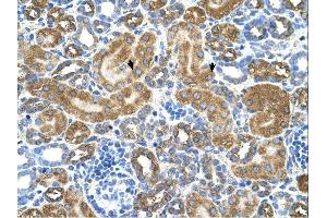 ATIC antibody was used for immunohistochemistry at a concentration of 4-8 ug/ml. (ATIC anticorps  (Middle Region))
