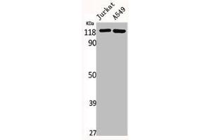 Western Blot analysis of Jurkat A549 cells using GCP5 Polyclonal Antibody (TUBGCP5 anticorps  (Internal Region))