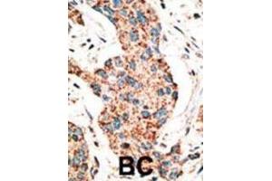 Immunohistochemistry (IHC) image for anti-RAD9 Homolog A (S. Pombe) (RAD9A) (BH3 Domain) antibody (ABIN2997201)