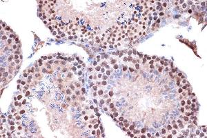 Immunohistochemistry of paraffin-embedded mouse testis using KIF4A Rabbit mAb (ABIN7268134) at dilution of 1:100 (40x lens).