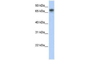 WB Suggested Anti-TRIM29 Antibody Titration:  0. (TRIM29 anticorps  (Middle Region))