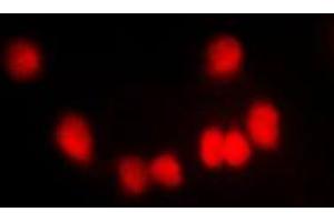 Immunofluorescent analysis of HKR1 staining in NIH3T3 cells. (HKR1 anticorps  (Center))