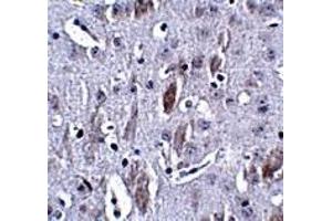 Immunohistochemistry (IHC) image for anti-Interleukin 16 (IL16) (N-Term) antibody (ABIN1031693)
