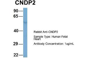 Host: Rabbit  Target Name: CNDP2  Sample Tissue: Human Fetal Heart  Antibody Dilution: 1. (CNDP2 anticorps  (Middle Region))