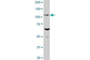 EVC MaxPab polyclonal antibody. (EVC anticorps  (AA 1-535))