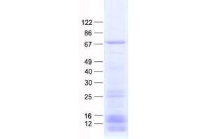 Validation with Western Blot