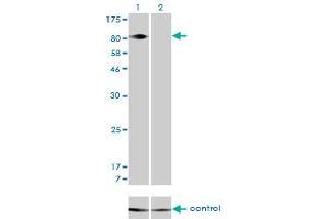 Western blot analysis of ITGB5 over-expressed 293 cell line, cotransfected with ITGB5 Validated Chimera RNAi (Lane 2) or non-transfected control (Lane 1).