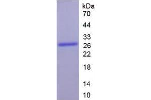 SDS-PAGE analysis of Human Cytochrome P450 1A1 Protein.