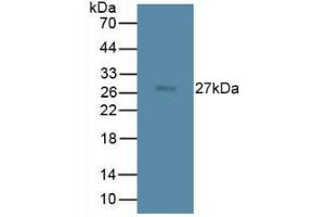 Western blot analysis of Rat Spleen Tissue. (TMEM27 anticorps  (Leu222))