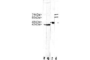 Strip blots of crude HeLa cell extract stained with MCS-4C4. (Lamin A/C anticorps)