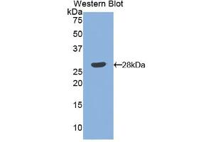 Western blot analysis of the recombinant protein. (Angiopoietin 1 anticorps  (AA 266-497))