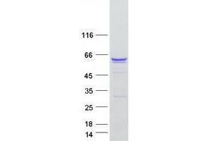 Validation with Western Blot