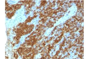 Formalin-fixed, paraffin-embedded human tonsil stained with CD45RA Mouse Monoclonal Antibody (111-1C5) (CD45 anticorps)
