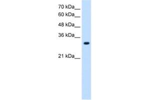 Western Blotting (WB) image for anti-Solute Carrier Family 7 (Amino Acid Transporter, L-Type), Member 8 (SLC7A8) antibody (ABIN2462749)