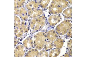 Immunohistochemistry of paraffin-embedded human stomach using UBIAD1 antibody (ABIN6293616) at dilution of 1:100 (40x lens).