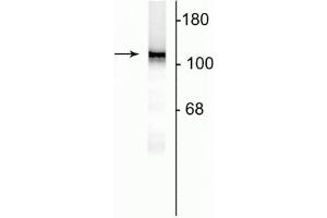 Western blot of 10 µg of rat hippocampal lysate showing specific immunolabeling of the ~120 kDa NR1 subunit of the NMDA receptor. (GRIN1/NMDAR1 anticorps  (AA 1-564))