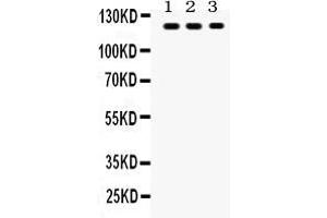 Anti- TLR7 Picoband antibody, Western blottingAll lanes: Anti TLR7  at 0.