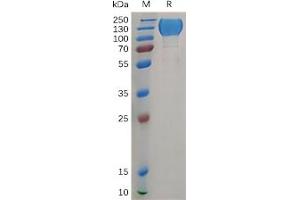 Human MERTK Protein, hFc Tag on SDS-PAGE under reducing condition.