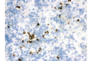 IHC analysis of Lipocalin 2 using anti-Lipocalin 2 antibody .