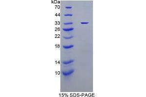 SDS-PAGE analysis of Mouse TP Protein.