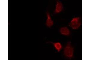 ABIN6273991 staining Hela by IF/ICC.