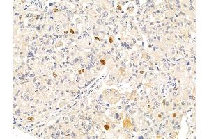 Anillin Antibody at 1/100 staining Rat stomach tissue by IHC-P. (Anillin anticorps  (C-Term))