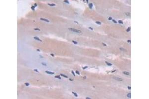 Used in DAB staining on fromalin fixed paraffin- embedded Kidney tissue