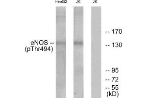 Western Blotting (WB) image for anti-Nitric Oxide Synthase 3 (Endothelial Cell) (NOS3) (pThr494) antibody (ABIN1847469) (ENOS anticorps  (pThr494))