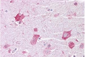 Immunohistochemistry with Brain, cortex tissue at an antibody concentration of 5µg/ml using anti-KCNQ2 antibody (ARP35458_P050)