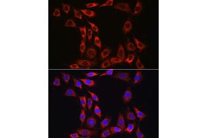 Immunofluorescence analysis of NIH/3T3 cells using IL15RA Rabbit pAb (ABIN3017117, ABIN1680439 and ABIN7101500) at dilution of 1:100 (40x lens).