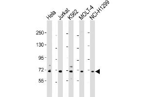 Western Blot at 1:2000 dilution Lane 1: Hela whole cell lysate Lane 2: Jurkat whole cell lysate Lane 3: K562 whole cell lysate Lane 4: MOLT-4 whole cell lysate Lane 5: NCI-H1299 whole cell lysate Lysates/proteins at 20 ug per lane. (NUP85 anticorps  (AA 163-195))