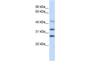 CENPH antibody used at 1 ug/ml to detect target protein. (CENPH anticorps  (Middle Region))