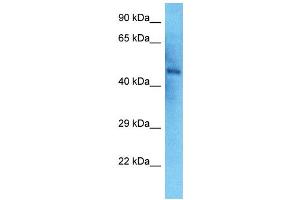 Host:  Rabbit  Target Name:  NEK2  Sample Type:  Thyroid Tumor lysates  Antibody Dilution:  1. (NEK2 anticorps  (N-Term))