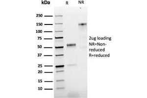 SDS-PAGE Analysis Purified NGFR Rabbit Recombinant Monoclonal Antibody (NGFR/1997R). (Recombinant NGFR anticorps)